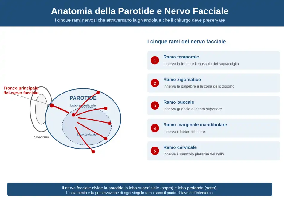 Anatomia della ghiandola parotide con tronco principale del nervo facciale e i suoi cinque rami: temporale, zigomatico, buccale, marginale mandibolare, cervicale