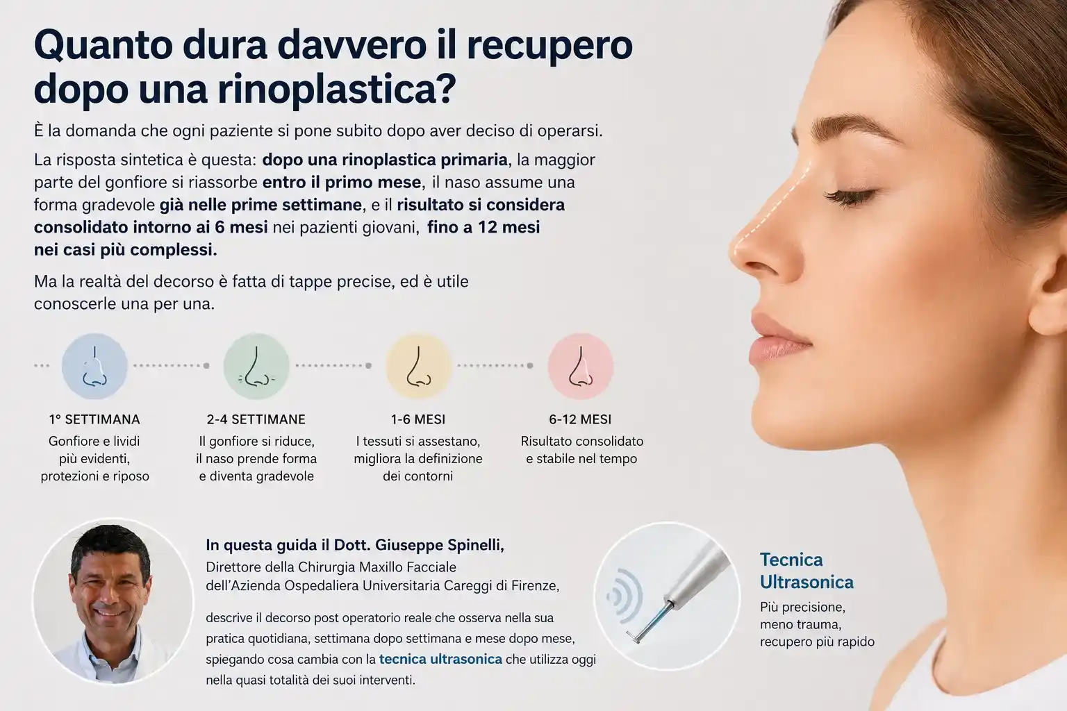Infografica con la timeline del recupero dopo rinoplastica mese per mese, dal Dott. Spinelli