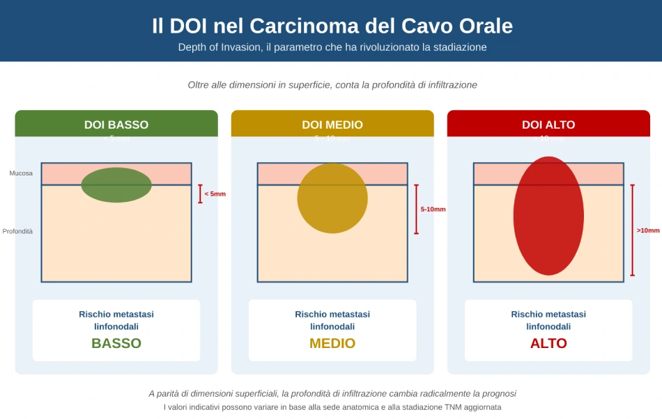 Il DOI (Depth of Invasion) nel carcinoma del cavo orale: tre livelli di profondità di infiltrazione del tumore con rischio crescente di metastasi linfonodali