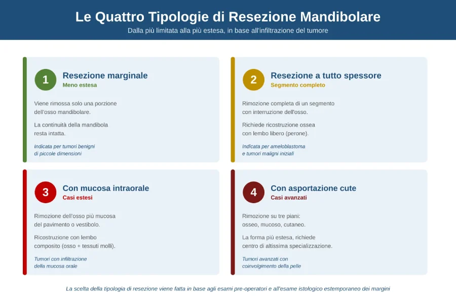 Le quattro tipologie di resezione mandibolare: marginale, a tutto spessore, con mucosa intraorale e con asportazione della cute